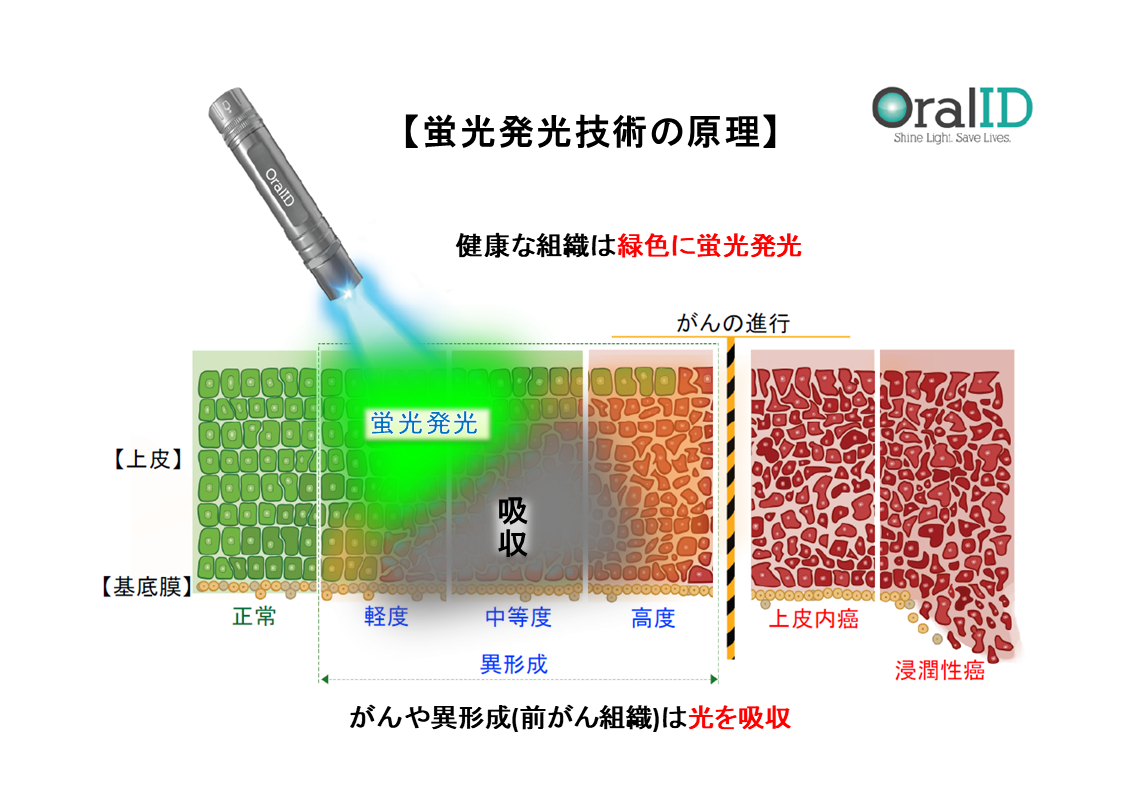 オーラルIDの蛍光発光技術の原理